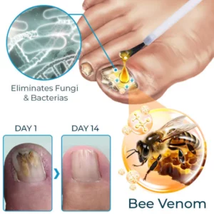 Fivfivgo™ Bee Venom Nail Fungus Treatment Solution