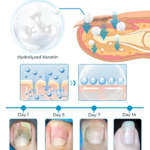 Fivfivgo™ Bee Venom Nail Fungus Treatment Solution