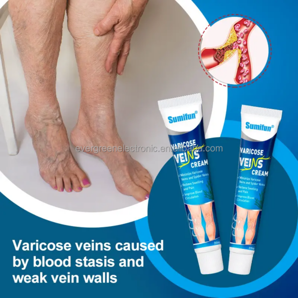 Banish™ Varicose Veins with Our Powerful Miracle Cream!