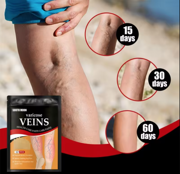 Varicose Veins Treatment Patches 12pcs