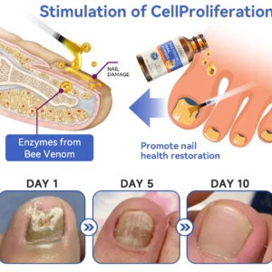 Furzero™ Bee Venom Nail Fungus Treatment: Restore Nail Health