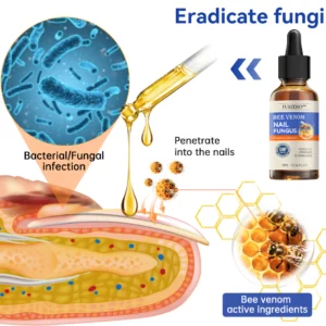 Furzero™ Bee Venom Nail Fungus Treatment: Restore Nail Health