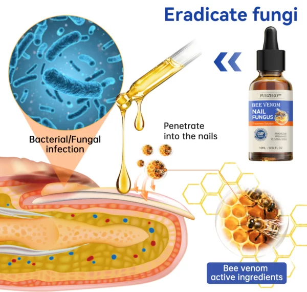 Furzero™ Bee Venom Nail Fungus Treatment: Restore Nail Health