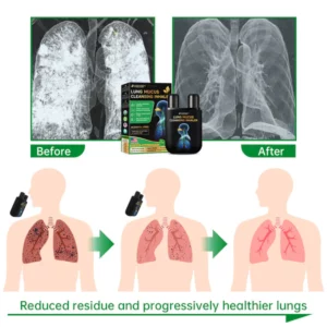 Raindew™ Lung Mucus Cleansing Inhaler