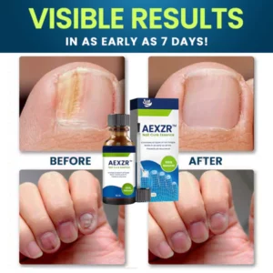 AEXZR™ Nail Cure Essence