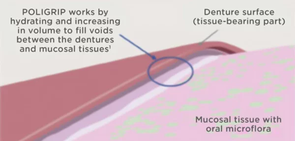 LOVILDS™Thermoplastic Denture Adhesive