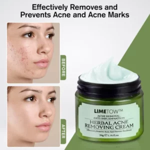 LIMETOW™ Herbal Acne Removal Cream