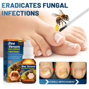 FLYCARE™ BeeVenom Nail Repair Treatment