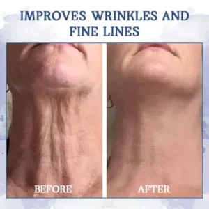 Fivfivgo™ Advanced Firming & Wrinkle-Reducing Cream