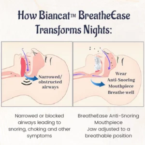 Biancat™ BreatheEase Anti