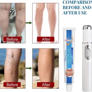 FIVFIVGO™ 415NM BLUE LIGHT VARICOSE VEINS THERAPY SET