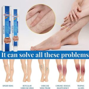 FIVFIVGO™ 415NM BLUE LIGHT VARICOSE VEINS THERAPY SET