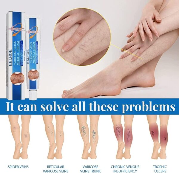 FIVFIVGO™ 415NM BLUE LIGHT VARICOSE VEINS THERAPY SET