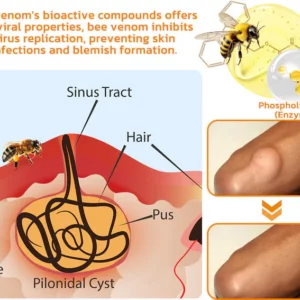 Awzlove™ Bee Venom Lipomas Therapy Cream