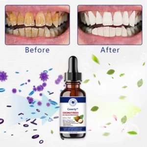 Ceoerty™ Coconut Fresh Oil-Pulling Mouthwash