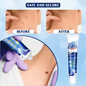 WartsOff PLUS cream for immediate removal of skin impurities (1+1 Free)