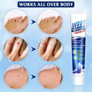 WartsOff PLUS cream for immediate removal of skin impurities (1+1 Free)