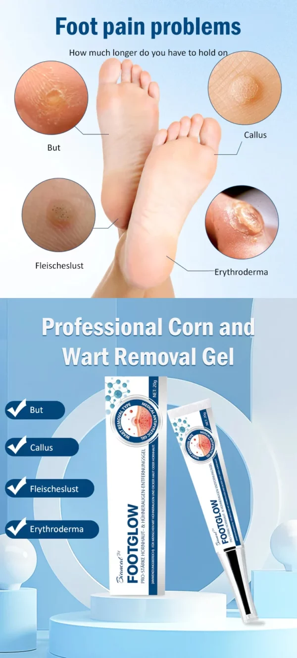 Professional Corn and Wart Removal Gel