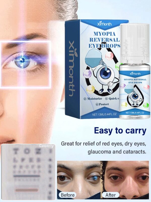 Ximonth Vision Care Drops