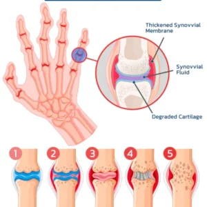 FIVFIVGO™ BEE VENOM ADVANCED JOINT AND BONE THERAPY CREAM