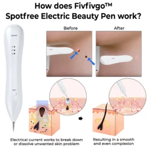 Fivfivgo™ Spotfree Electric Beauty Pen