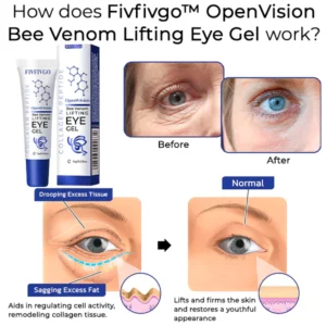 Fivfivgo™ OpenVision Bee Venom Lifting Eye Gel