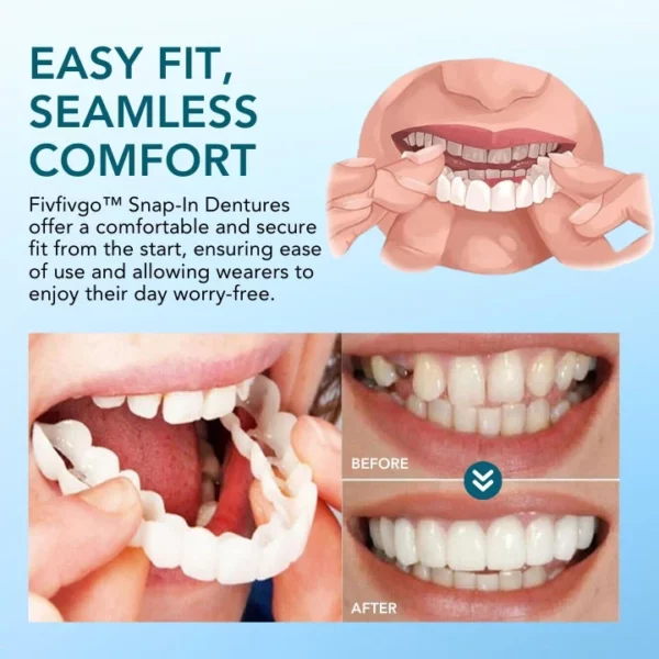 Fivfivgo™ Snap-In Dentures