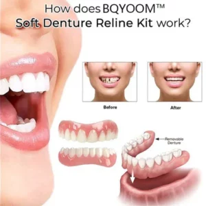 BQYOOM™ Perfect-Bite Soft Denture Silicone Reline Kit