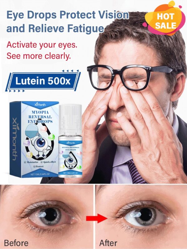 Ximonth Vision Care Drops