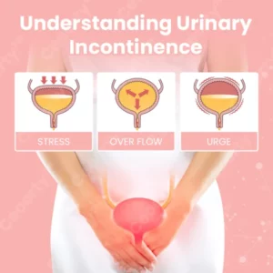 Tiworld™ Urinary incontinence gel