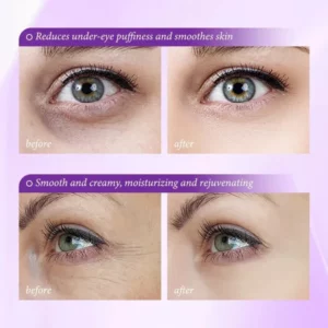 LOVILDS Skin Renewing Eye Cream For Wrinkles