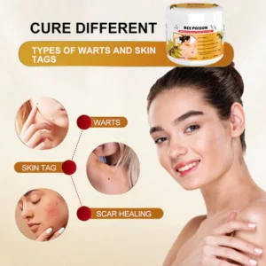 LOVILDS™ Bee Poison Mole and Wart Treatment Cream