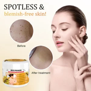 LOVILDS™ Bee Poison Mole and Wart Treatment Cream