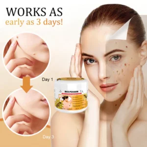 LOVILDS™ Bee Poison Mole and Wart Treatment Cream