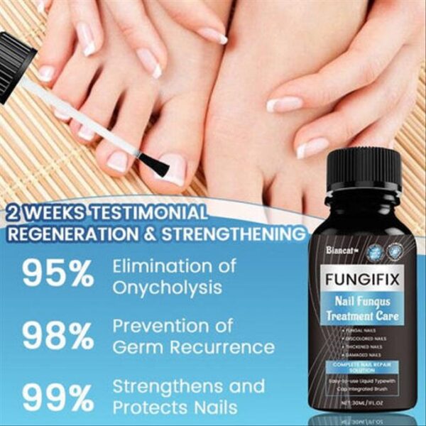 FungiFix Nail Fungus Treatment Care Fluid