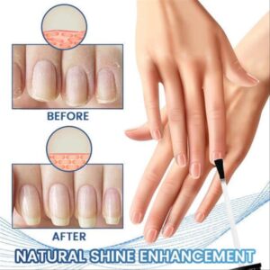 FungiFix Nail Fungus Treatment Care Fluid