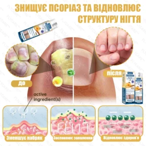 Professional remedy against psoriasis on the body