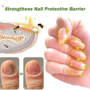 Nail serum with bee venom - growth and eliminates fungus in 10 days