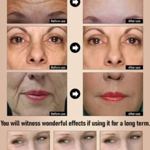 Anti-Aging Wrinkle-Removing Serum