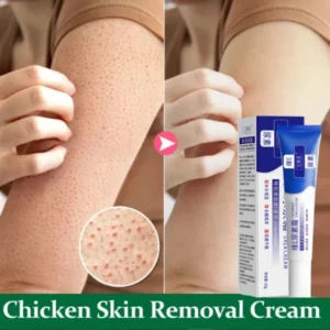 Curing Keratosis Pilaris Chicken Follicle Skin Repair Cream