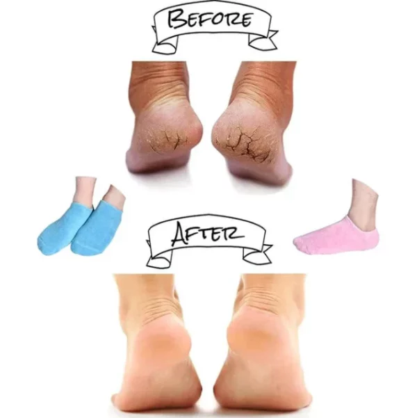 Moisturizing Socks with Gel Lining