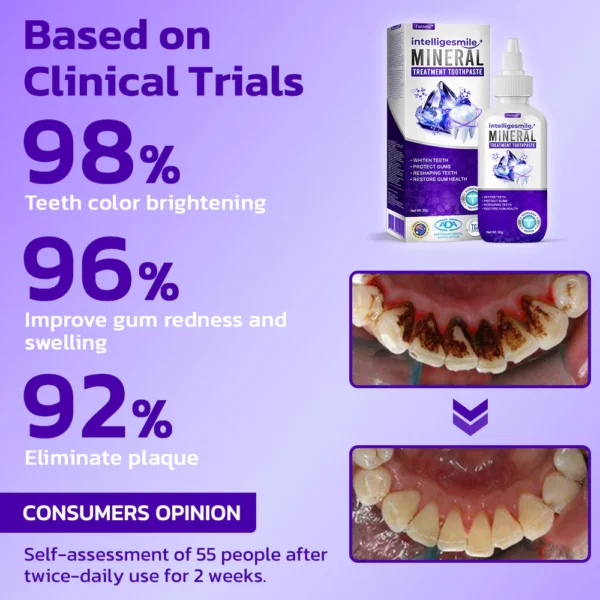 Furzero™ IntelligeSmile Mineral Treatment Toothpaste 1+1 Set