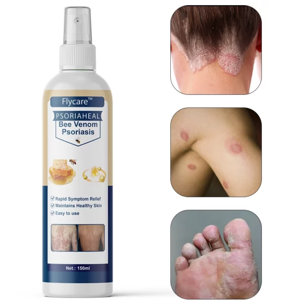 Professional remedy against psoriasis on the body