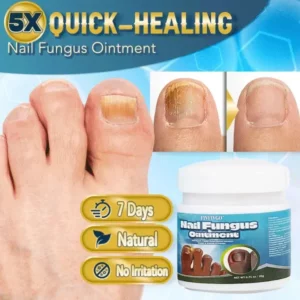 Fivfivgo™ 5X Fast Healing Nail Fungus Ointment