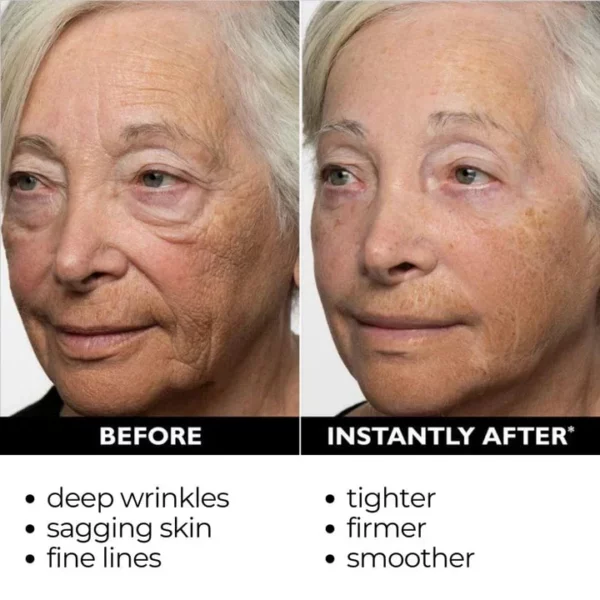 Instant FIRMx Temporary Face Tightener