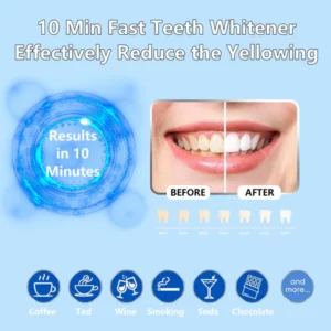 NESLEMY Original Teeth Whitening Kit with 5x LED Light, 18% Carbamide Peroxide Oral Care