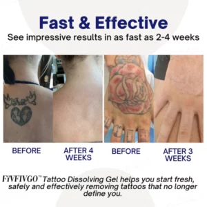 Fivfivgo™ Tattoo Vanishing Gel