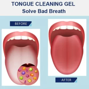 Probiotic Tongue Cleaning Gel Set