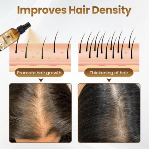 CVREOZ™ Biotin Hair Growth Premium Serum - Proven and Tested by Experts!