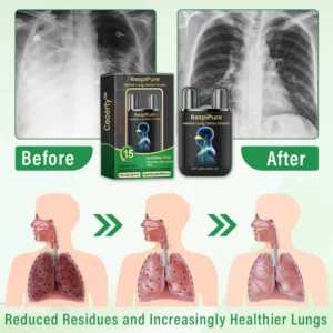 Ceoerty™ RespiPure Herbal Lung Detox Inhaler